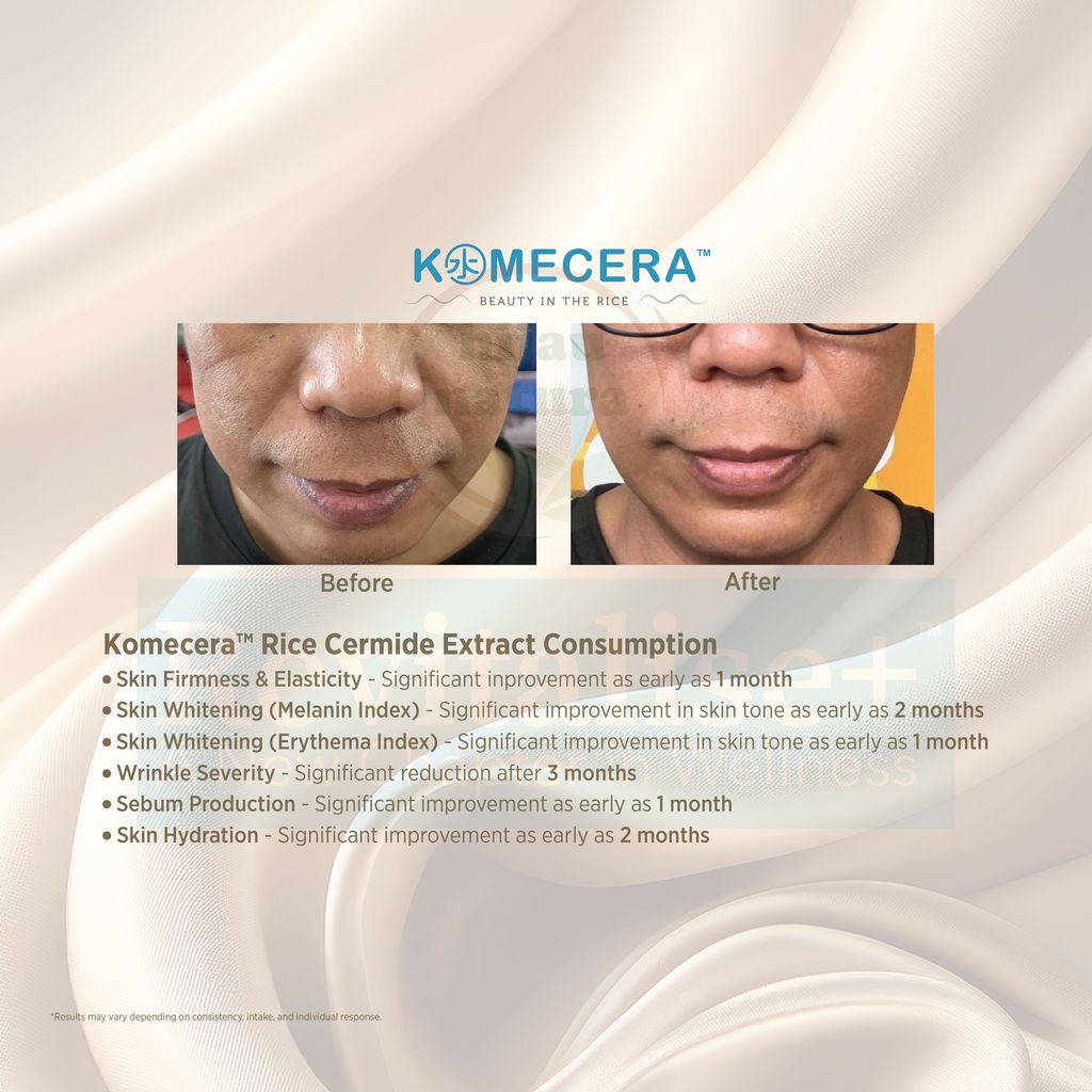 komecera-1
