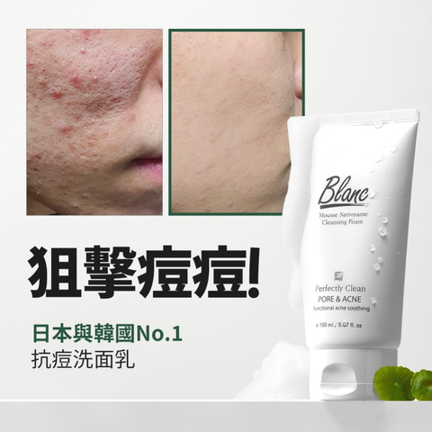 淨化抗痘洗面乳150ml 2
