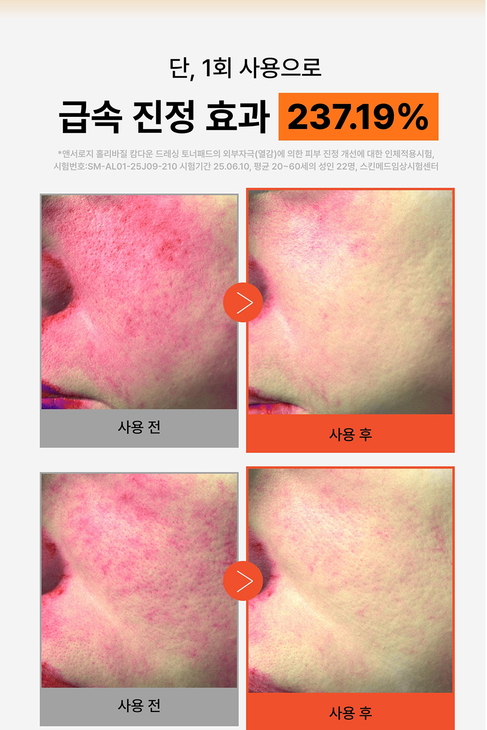 Tonerpad-KR_EDM_01_04