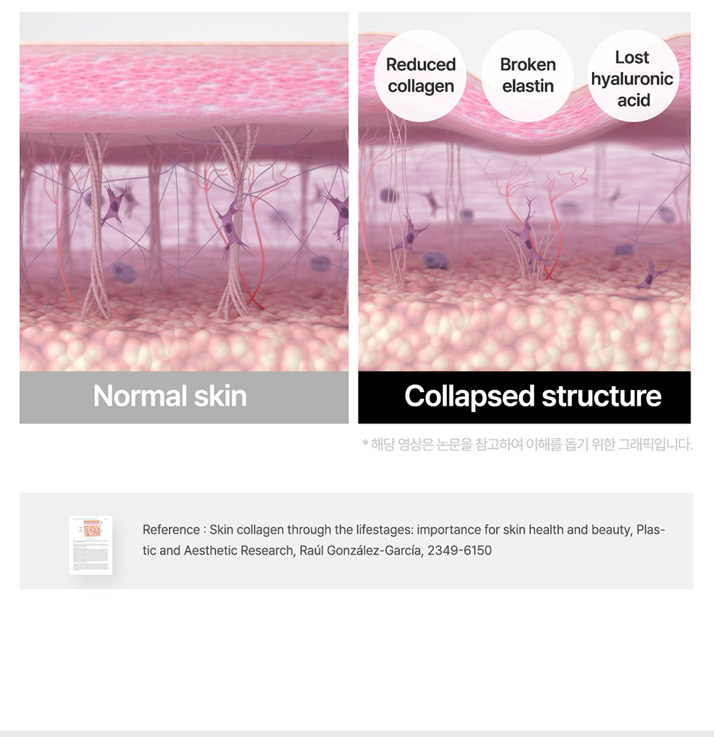 description_bouncy_EN_02_02