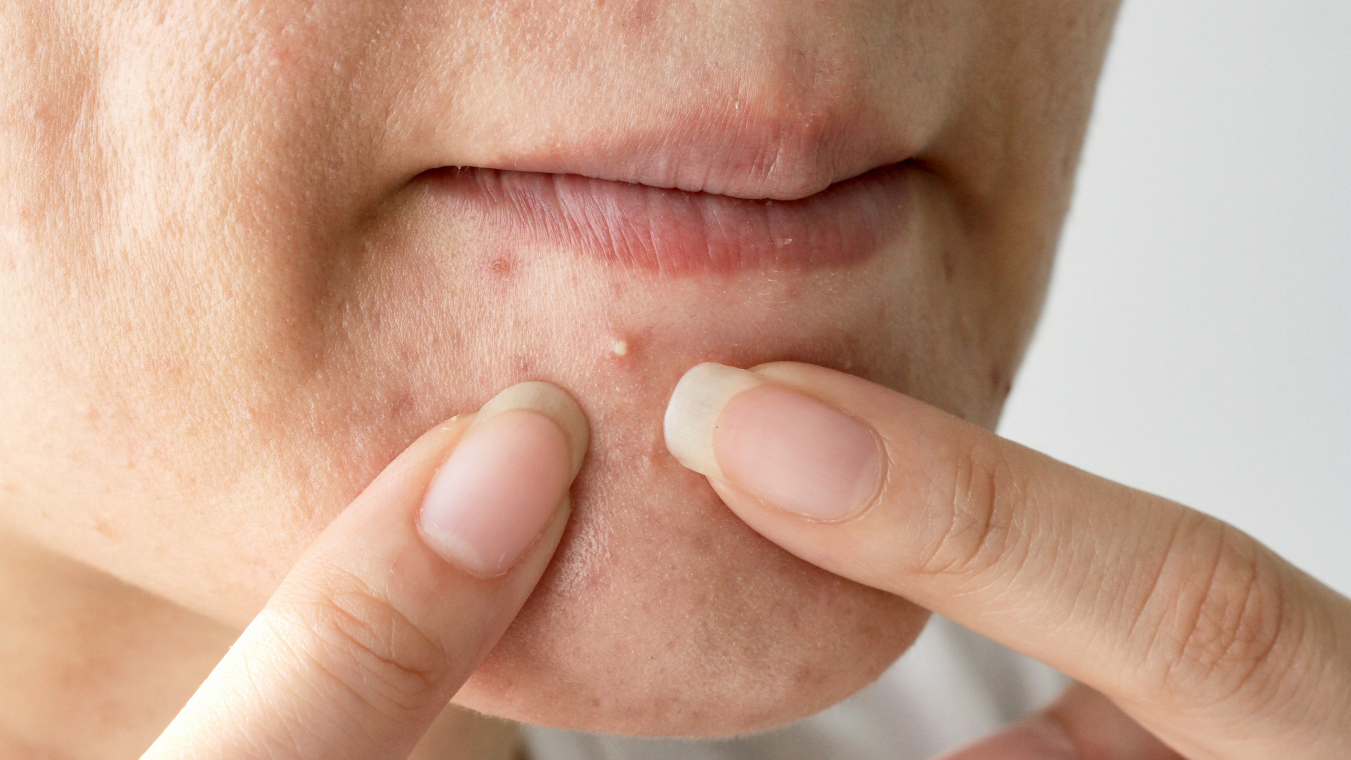 Stressed Skin Signs, Impacts, and Solutions for a Healthy Skin Barrier (1)