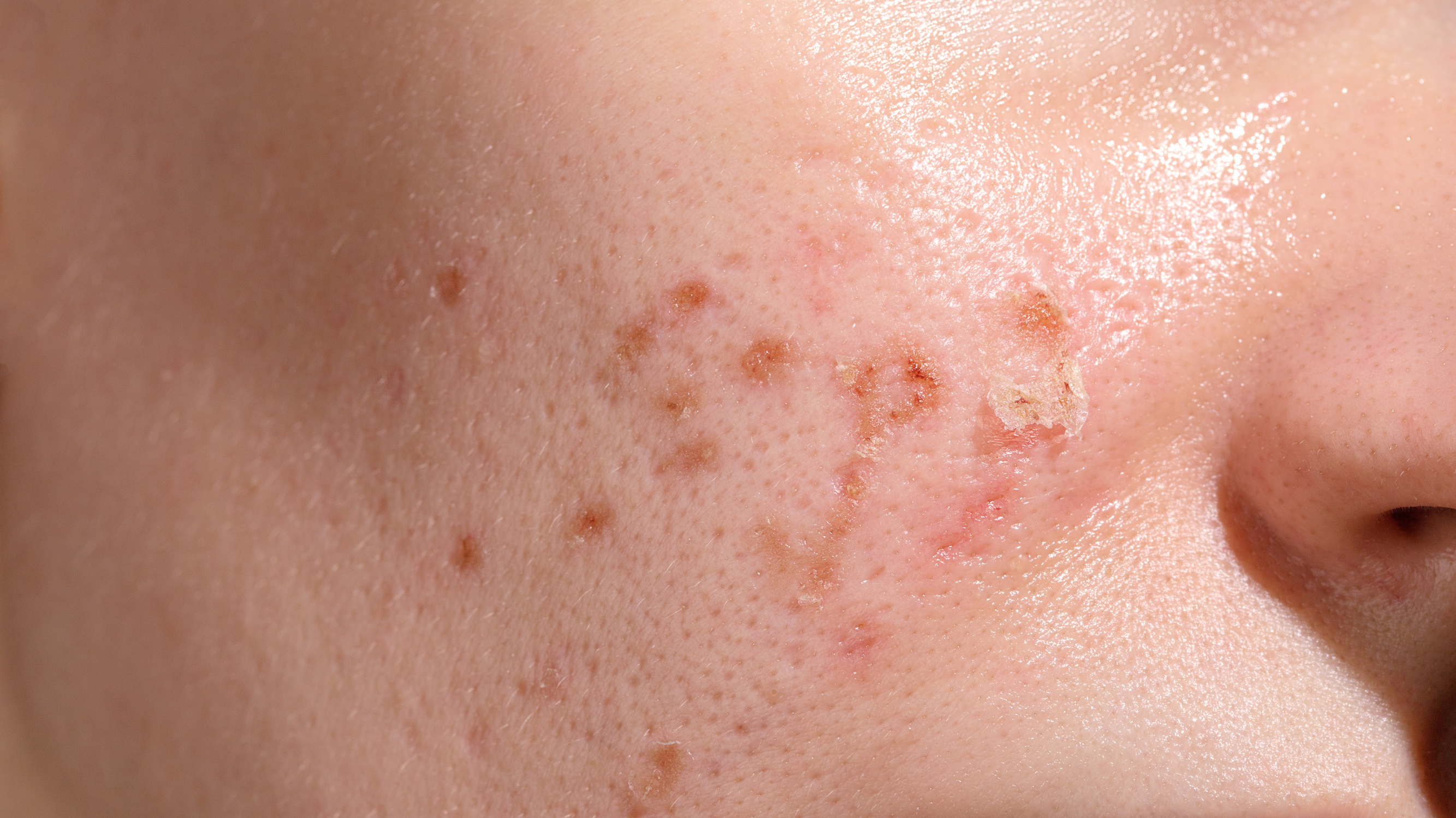 Stressed Skin Signs, Impacts, and Solutions for a Healthy Skin Barrier (2)