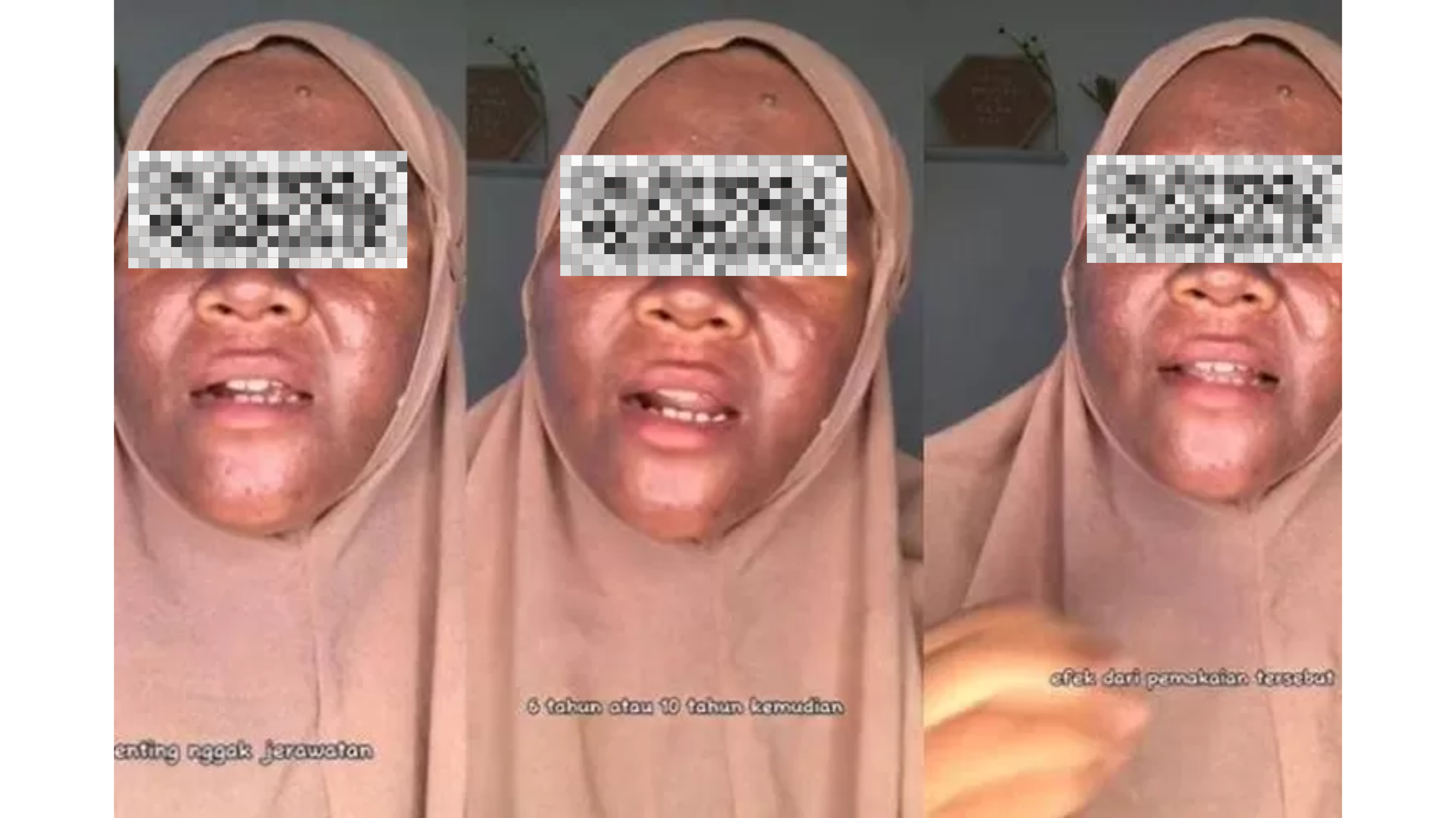 Mercury in Skincare_ The Hidden Danger Every Malaysian Should Know (3)