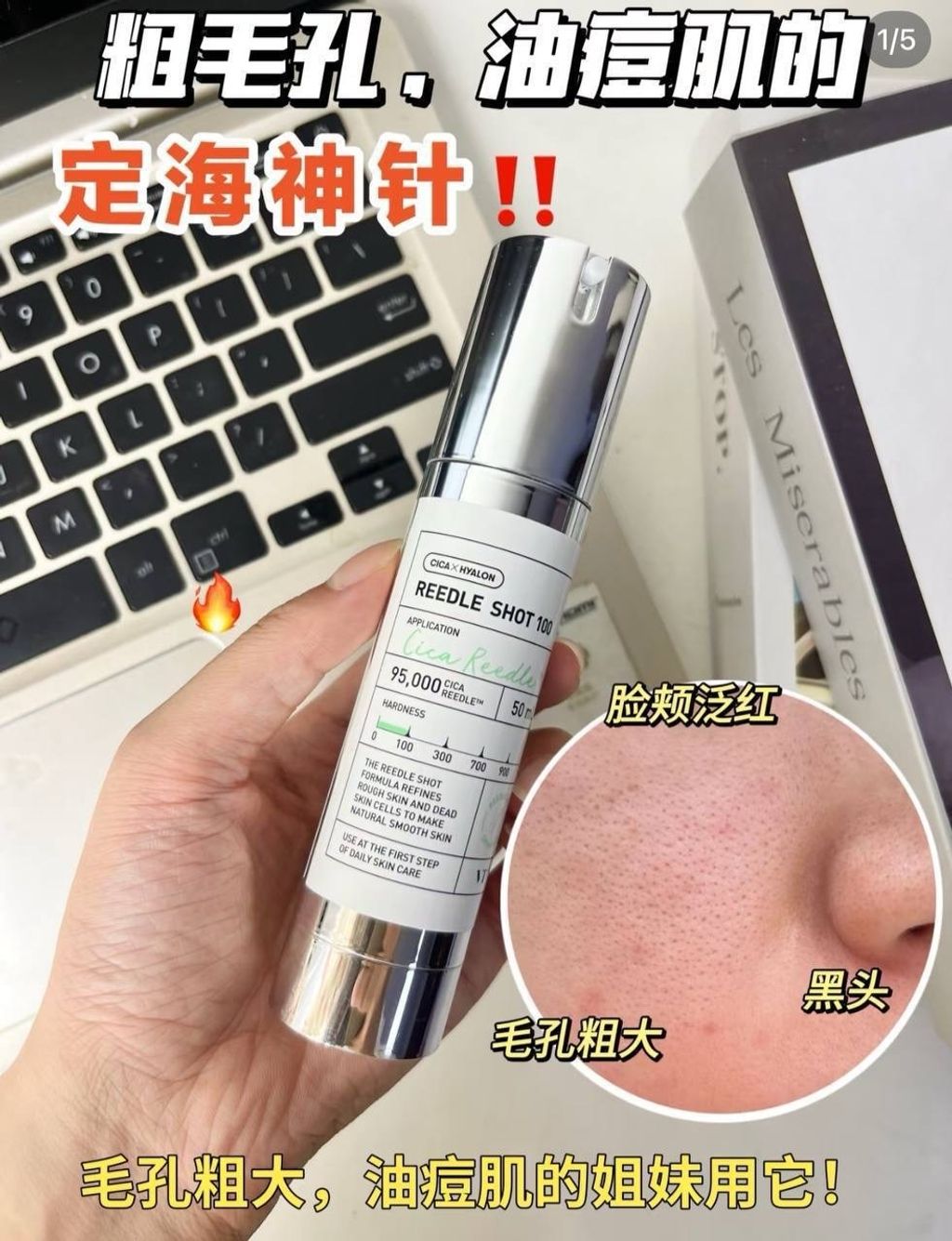 image_31A795FC-DB73-4312-959F-35B4DECDEEBF_1767864362