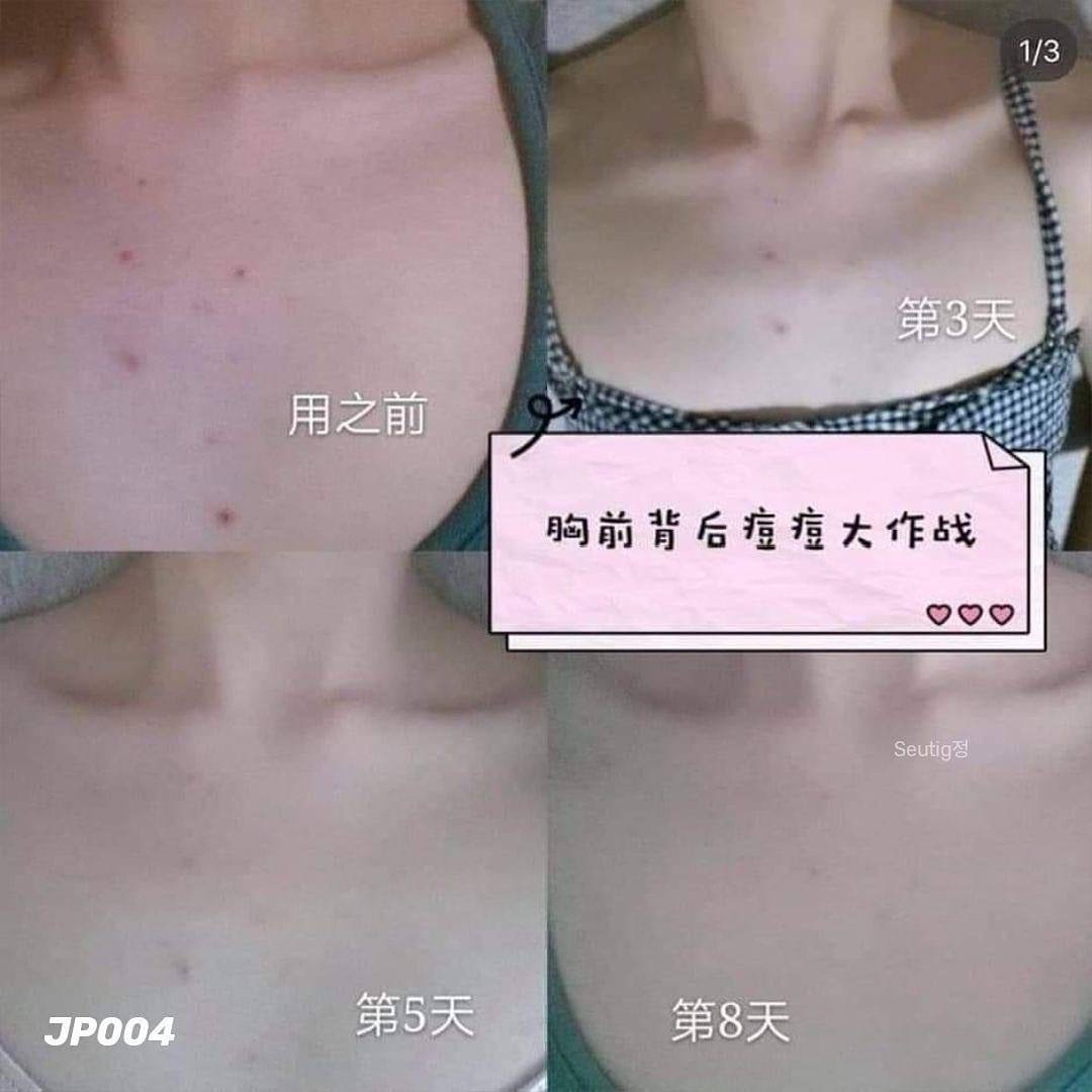 image_353DF81A-43A3-4713-9161-40156FEFA3A0_1755617456