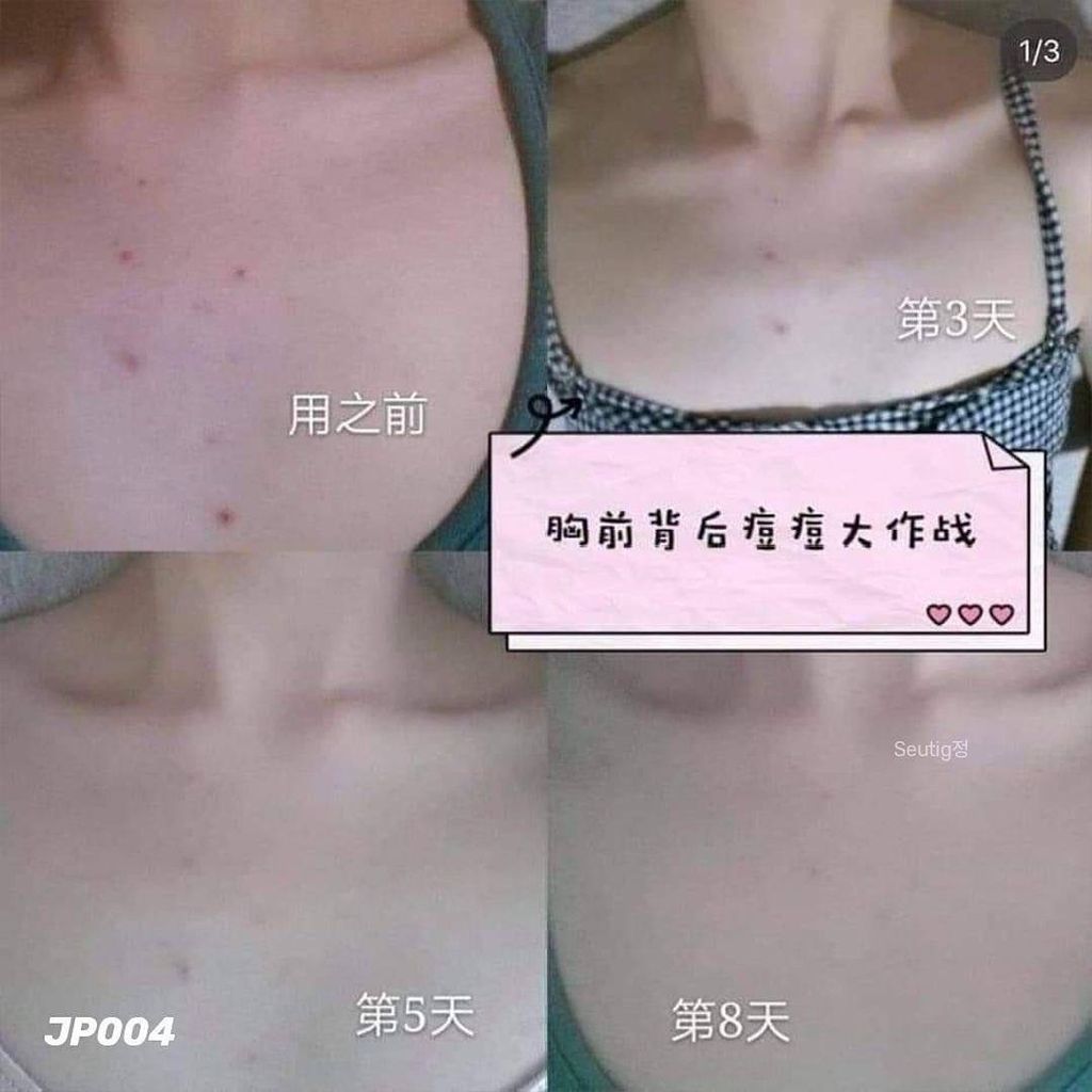 image_353DF81A-43A3-4713-9161-40156FEFA3A0_1755617456