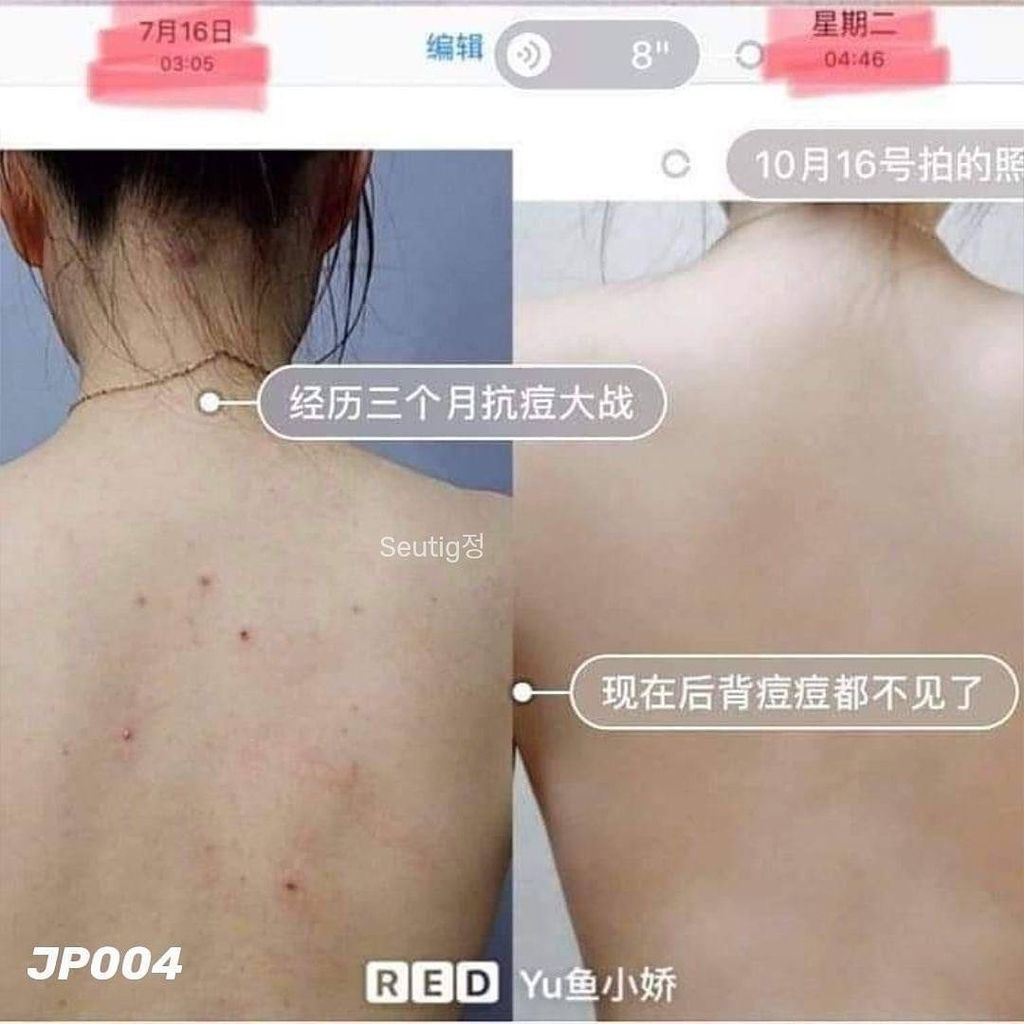 image_9E053F90-6F74-4C5D-BA4E-07BB2D50BA69_1755617456