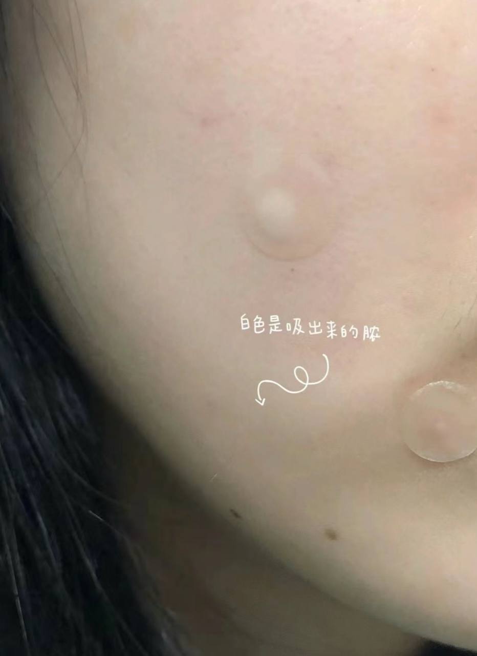 image_10264C4F-D6B9-4C6B-B85A-8BE33EAA92DD_1763645587