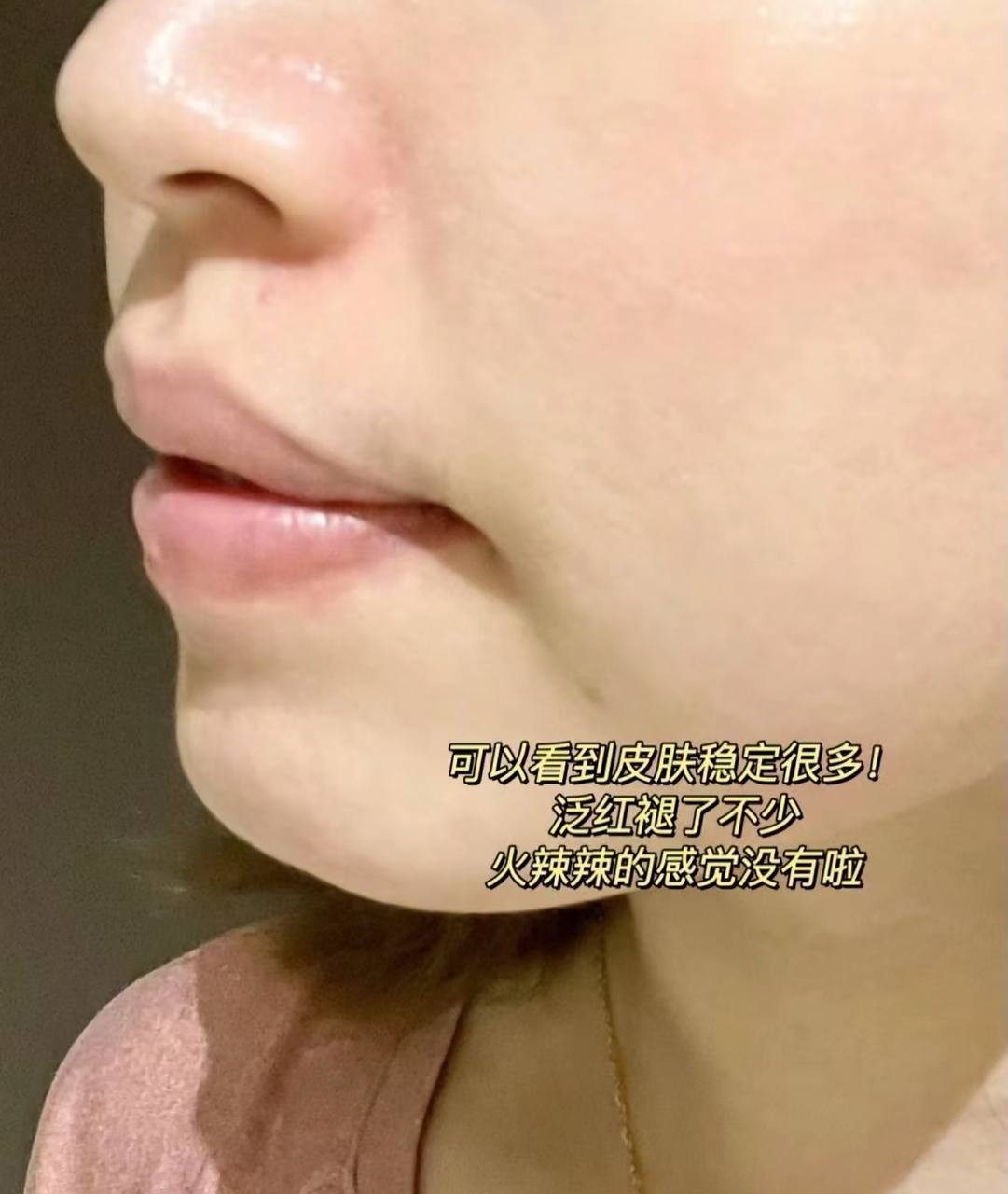 image_4C2D7C10-4DAD-4F96-89C0-58CD48133782_1764826627