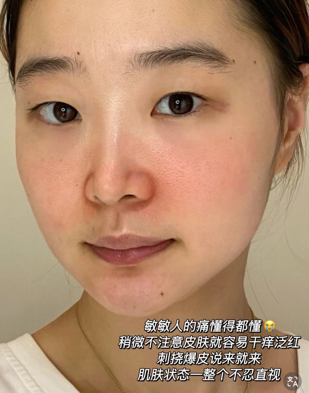 image_3D87BDED-08DE-417B-B86F-9795E08884F2_1764826704