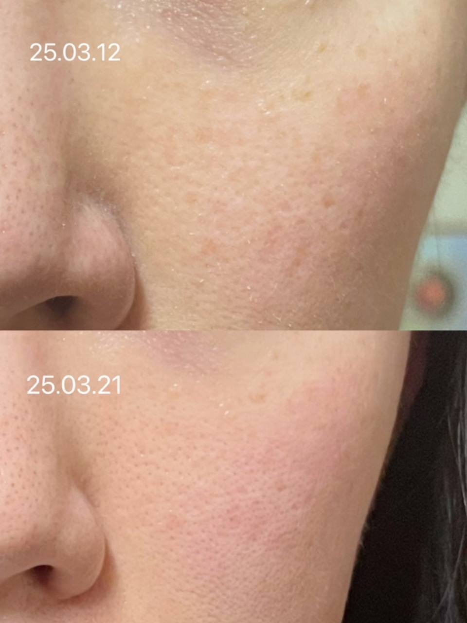 image_32EAA41F-6ED6-4E84-86A4-82112D7E8D9D_1764829285