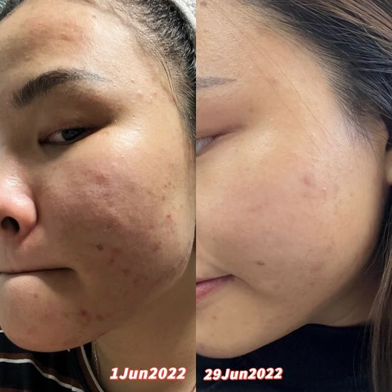 MINS全系列效果图 | TWINKO BEAUTY EMPIRE