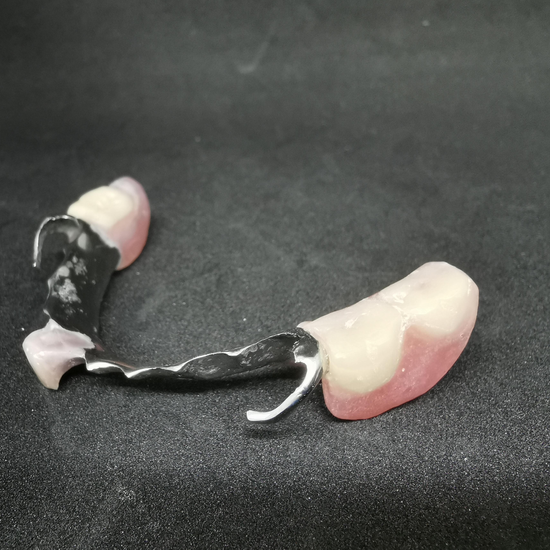 Chrome Cobalt  | Nexus Denture Lab Services