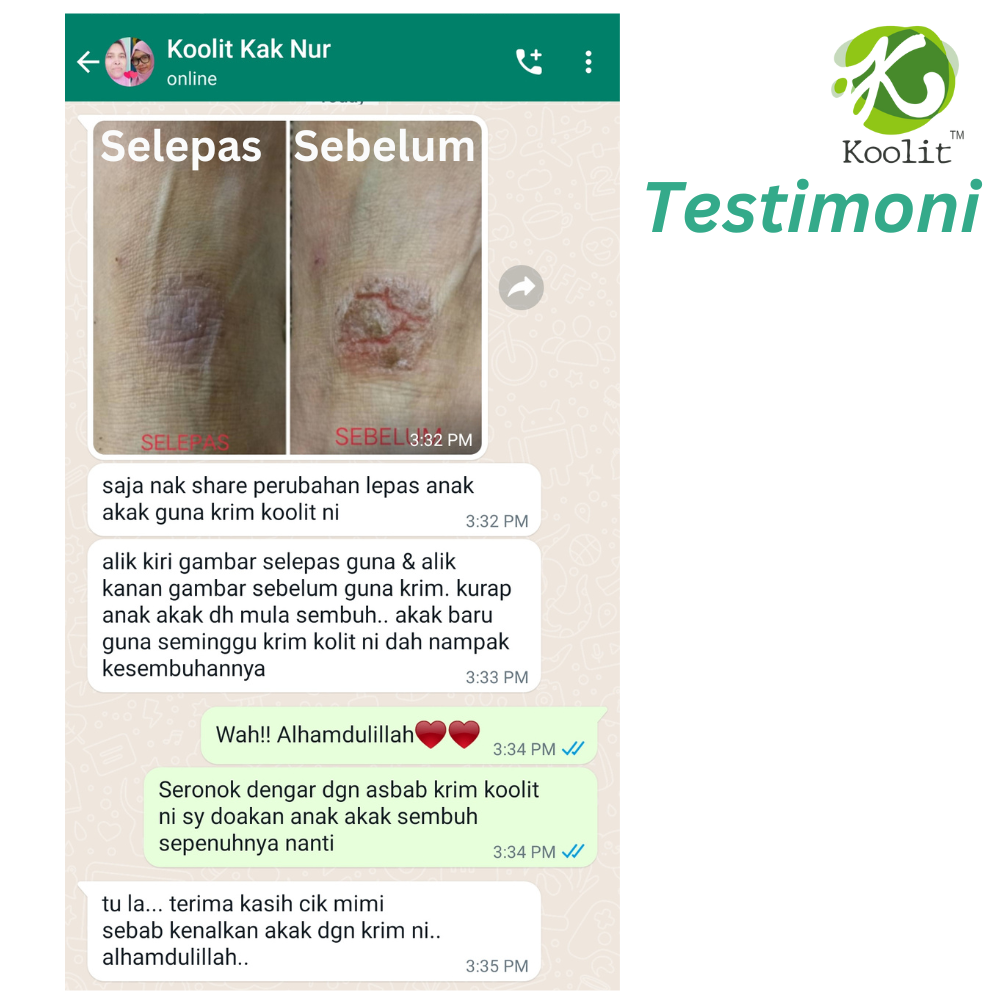Testimony 4