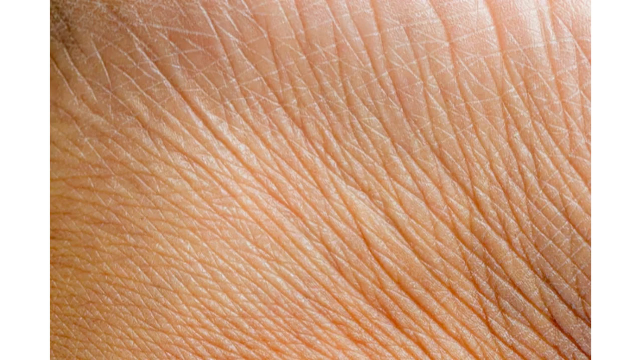 Can Dry Skin Use Niacinamide?