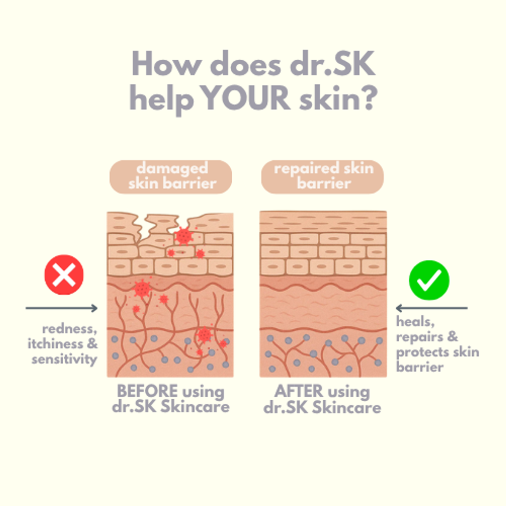 skin barrier diagram