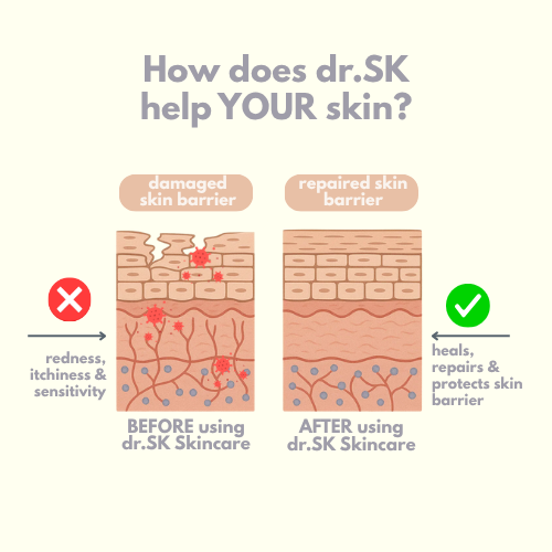 Illustration showing how dr.SK Skincare heals and repairs damaged skin barrier for dry and sensitive skin