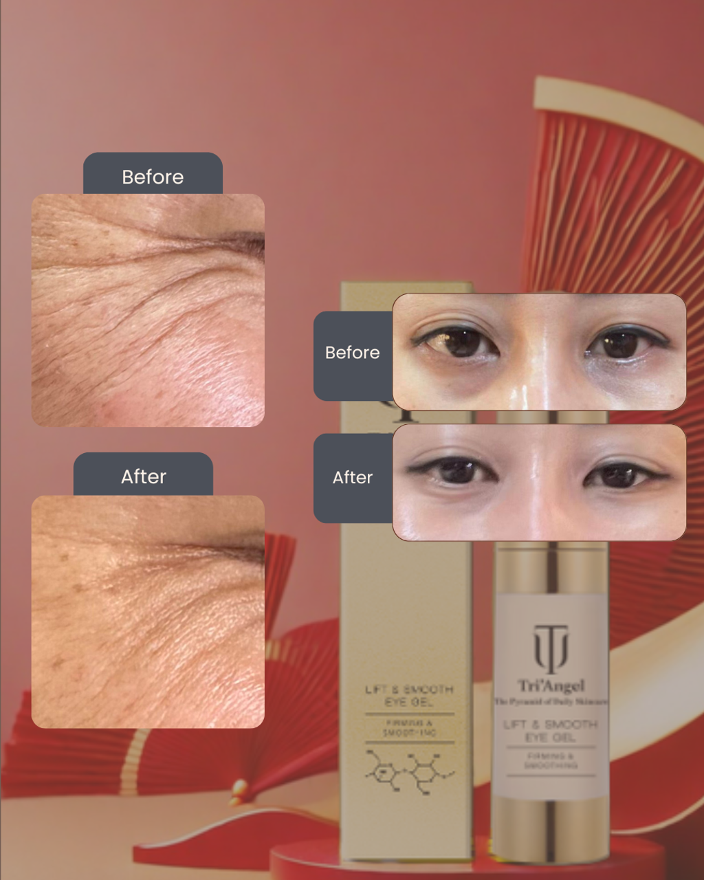 EYE gel' (312 x 390 px) (1)