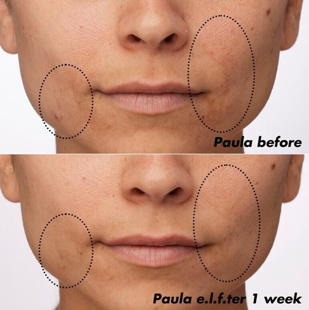 PlzClarify_Paula_B+A_0