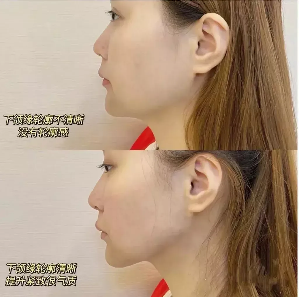 IMG_5924-1716277118698