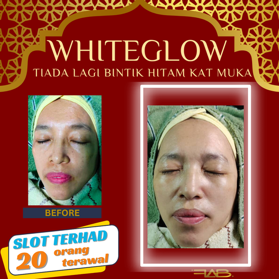 GLOW SAKAN RAYA NI JOM | FAB MEDISPA
