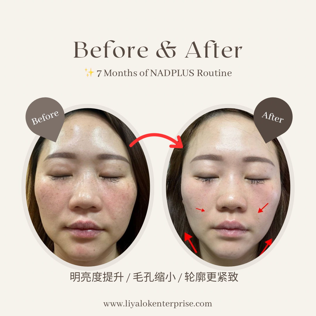 NADPLUS-OPC3-skin-improvement-before-after-7months-zh.jpg