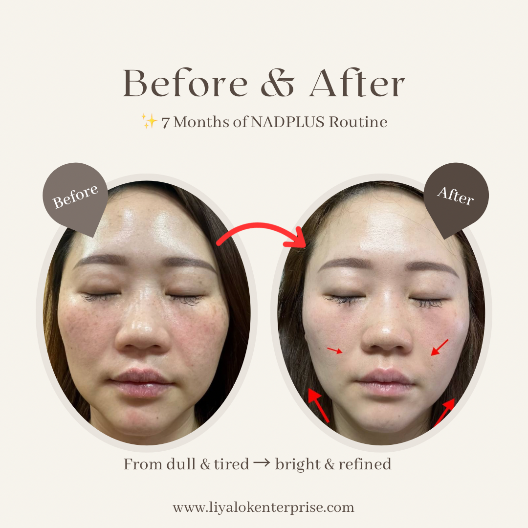 NADPLUS-OPC3-skin-improvement-before-after-7months.jpg