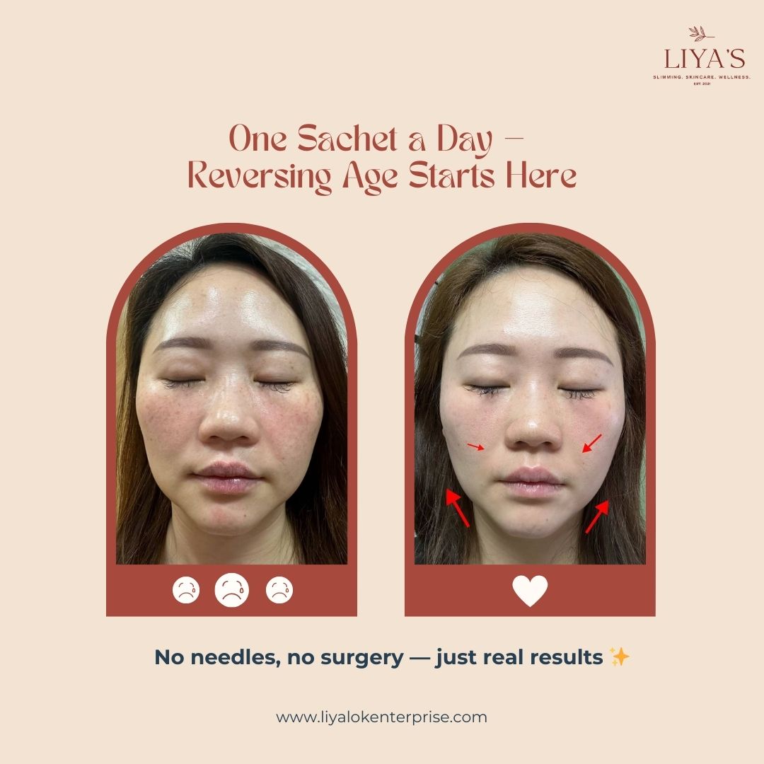 Choice NAD+ 7-Month Transformation - Jawline Lifting & Radiant Skin | LIYA'S