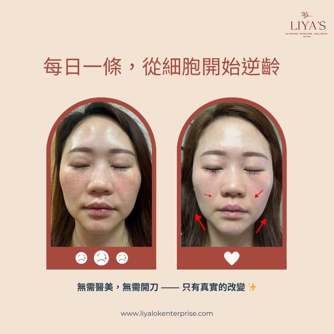 Choice NAD+ 7個月真實見證 - 輪廓提拉與膚色煥亮 | LIYA'S