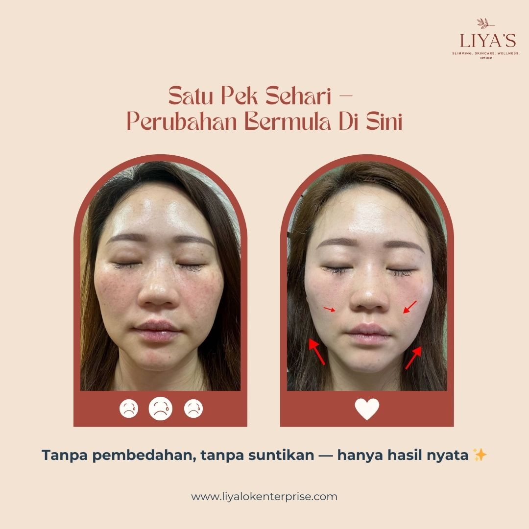 Testimoni Sebenar Choice NAD+ 7 Bulan - Penegangan Kulit & Wajah Berseri | LIYA'S