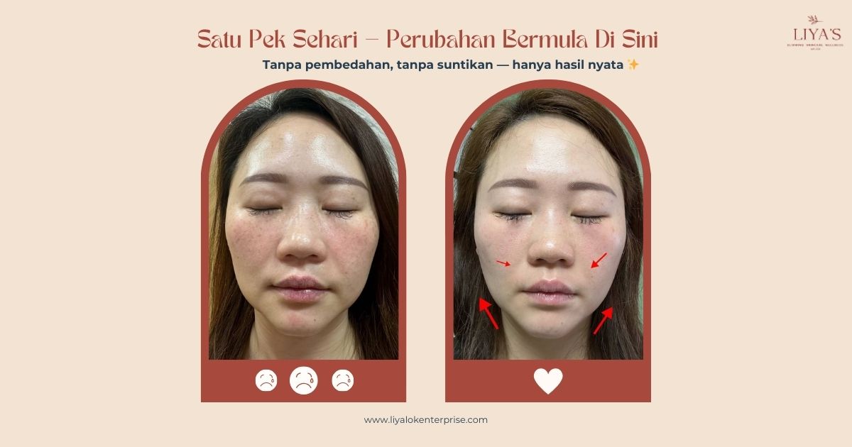 Testimoni Sebenar Choice NAD+ 7 Bulan: Rahsia Wajah V & Awet Muda | LIYA'S