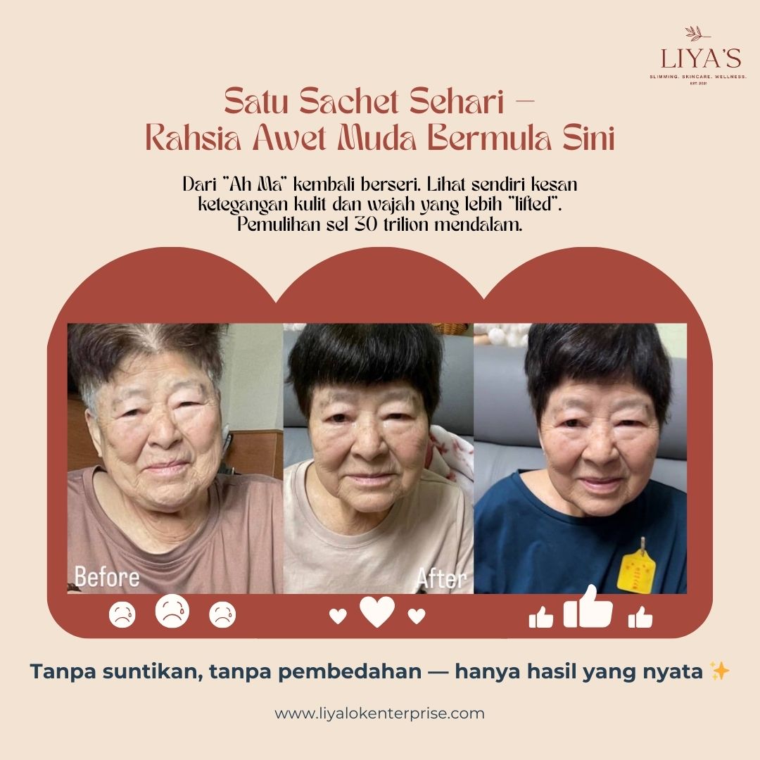 Transformasi Ah Ma: Rahsia Satu Sachet NAD+ Sehari untuk Awet Muda & Tegangkan Kulit