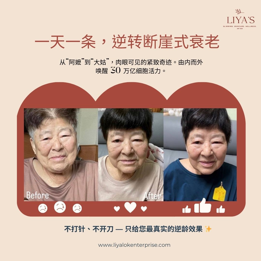 从“阿嬷”变回“年轻光彩”：揭秘一天一条 NAD+ 的细胞级逆龄奇迹