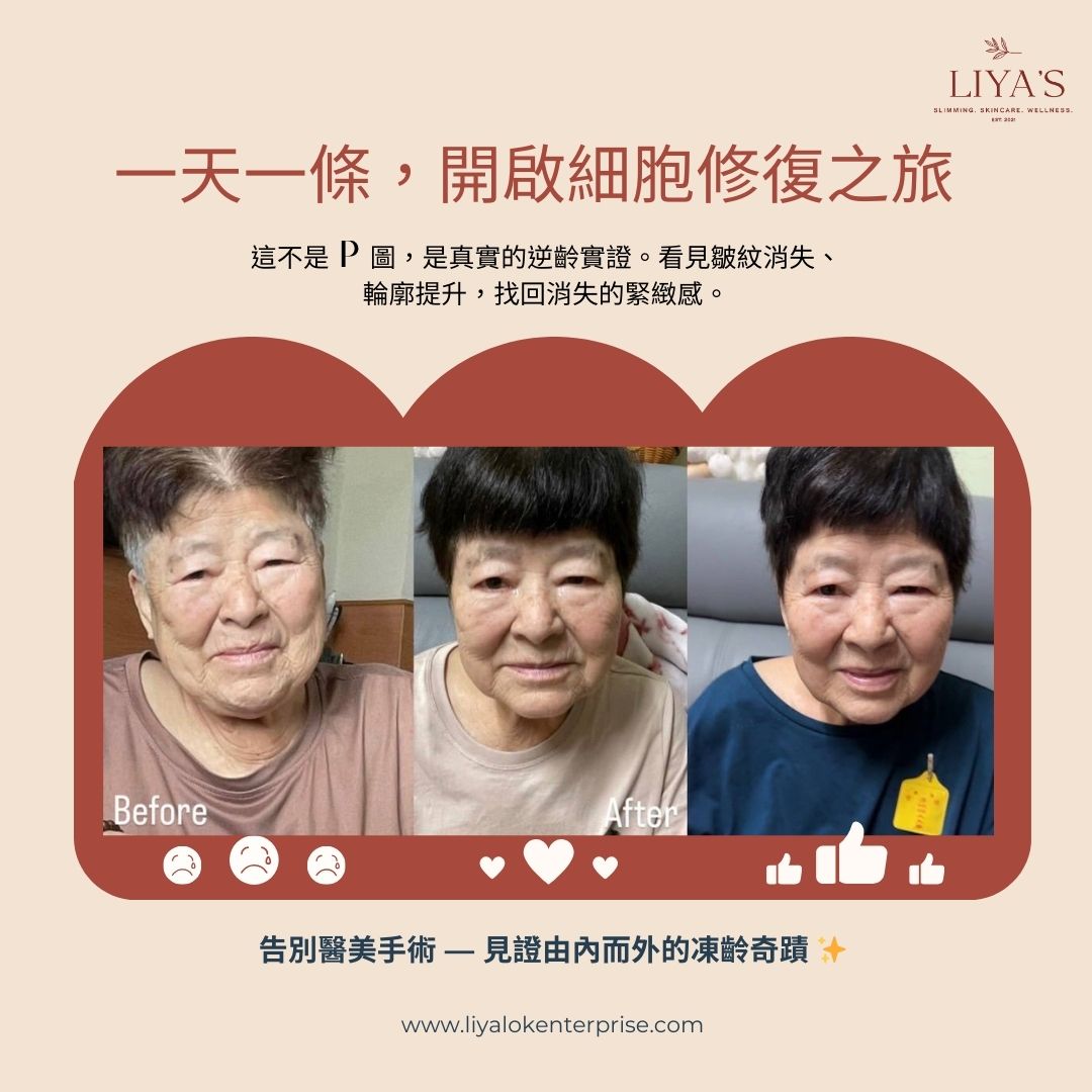 從“阿嬤”變回“年輕光彩”：揭秘一天一條 NAD+ 的細胞級逆齡奇蹟