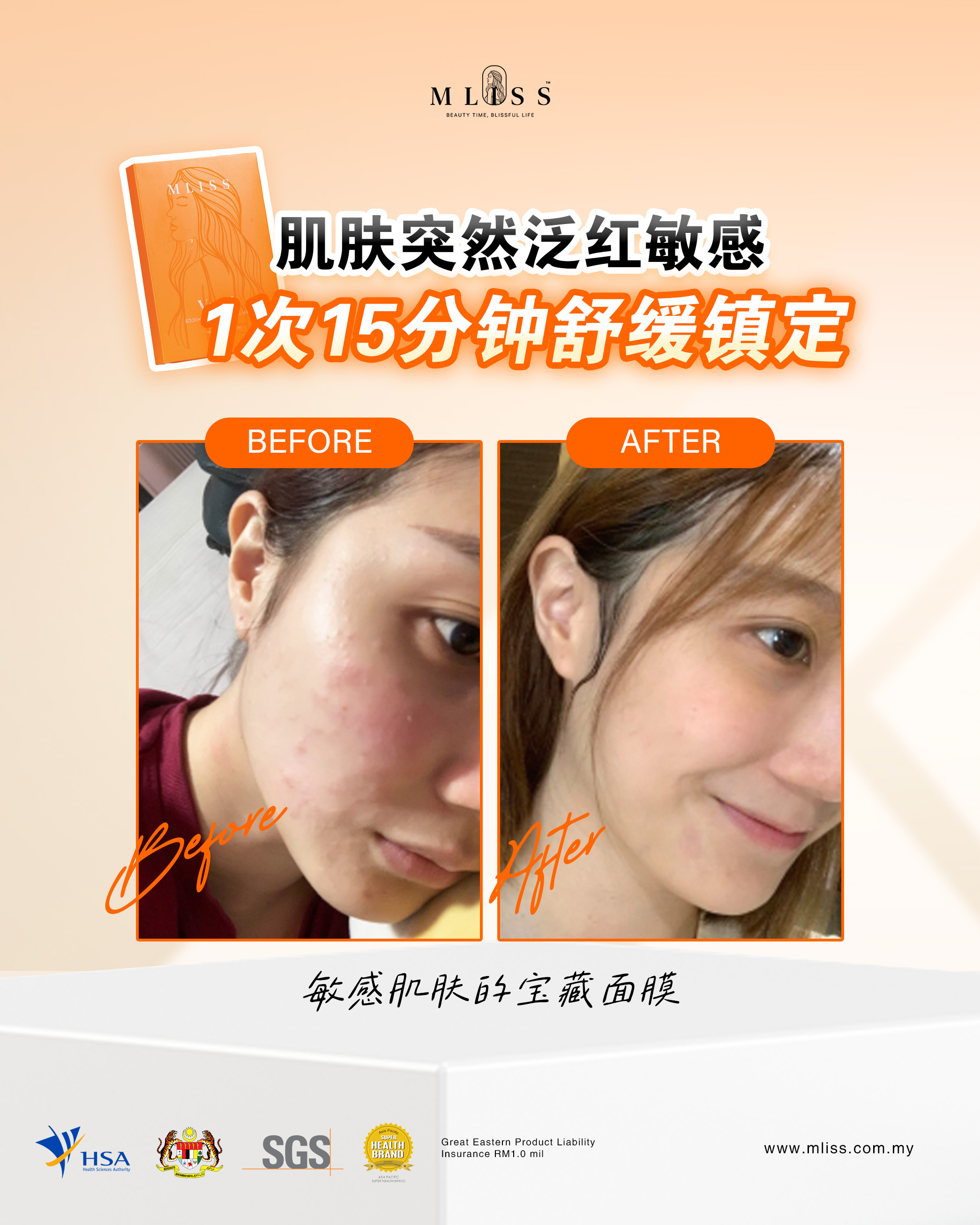 [TW] 修復屏障首選：MLISS™ Vcare 面膜 15分鐘鎮定泛紅敏感，找回醫美級水光肌