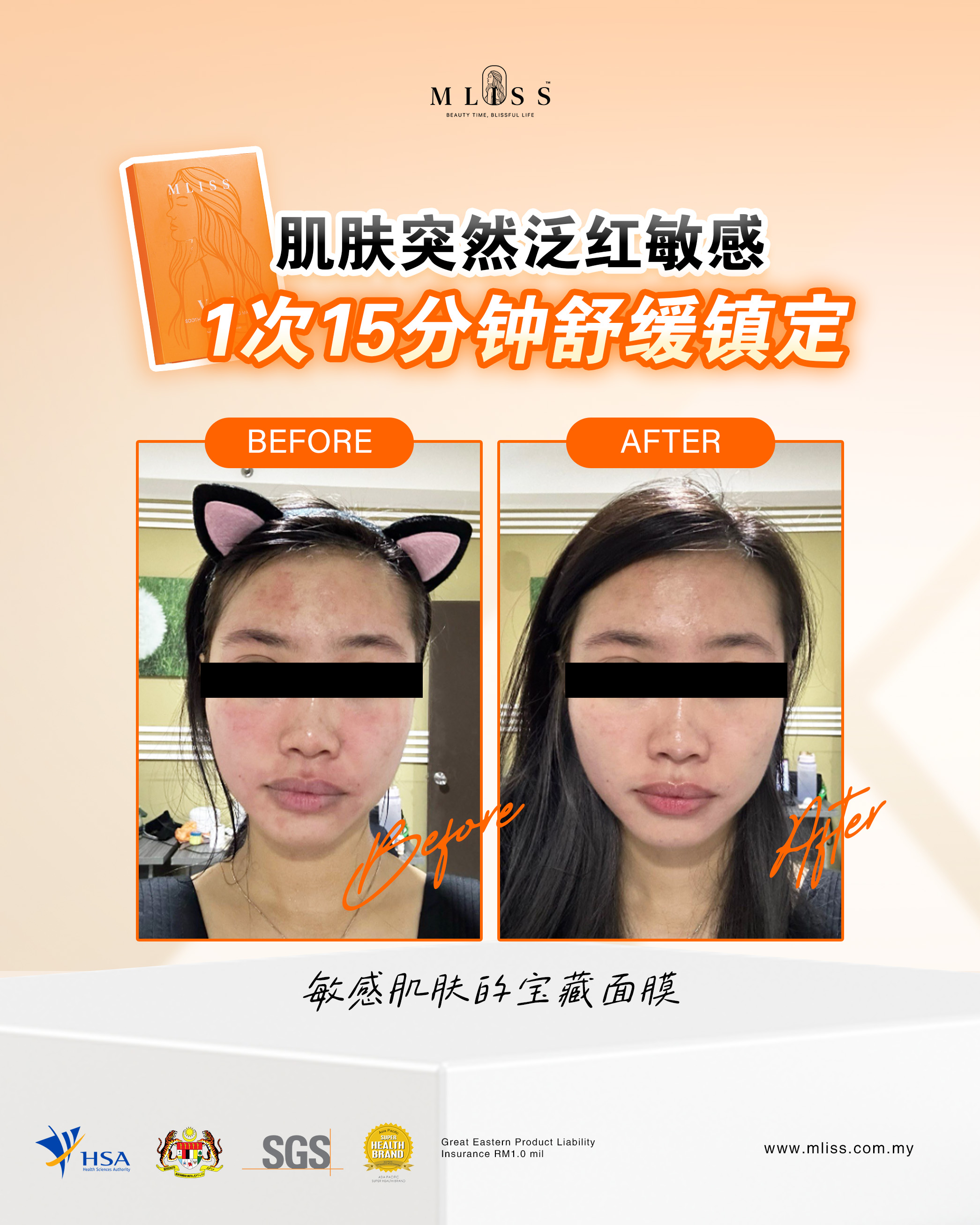 Vcare Mask Before After