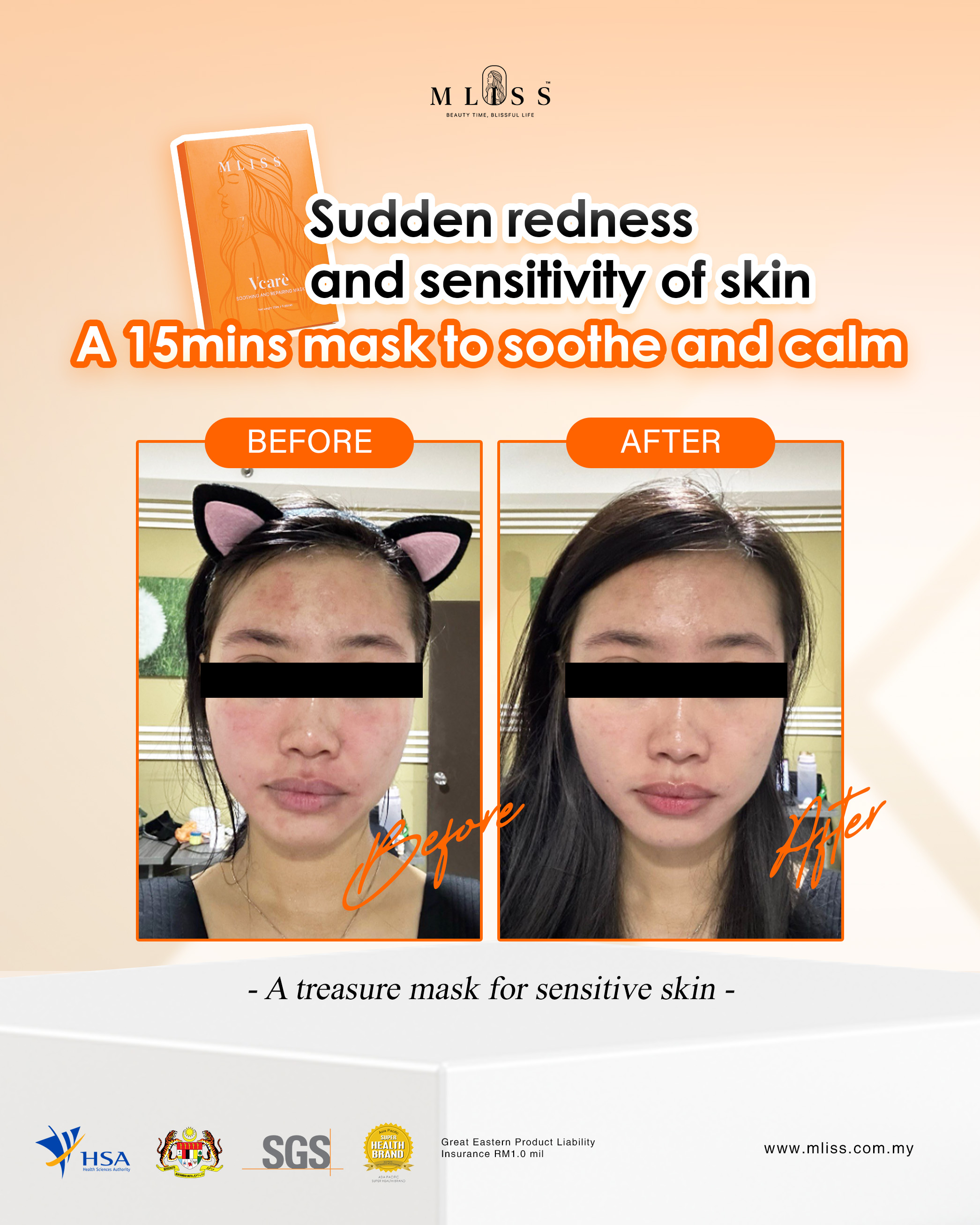 Vcare Mask Before After Real Testimony