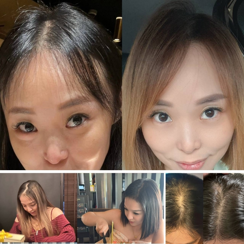 MLISS DailyCare 沙龍級育髮洗護見證 - 活化毛囊、改善髮縫與蓬松髮量對比
