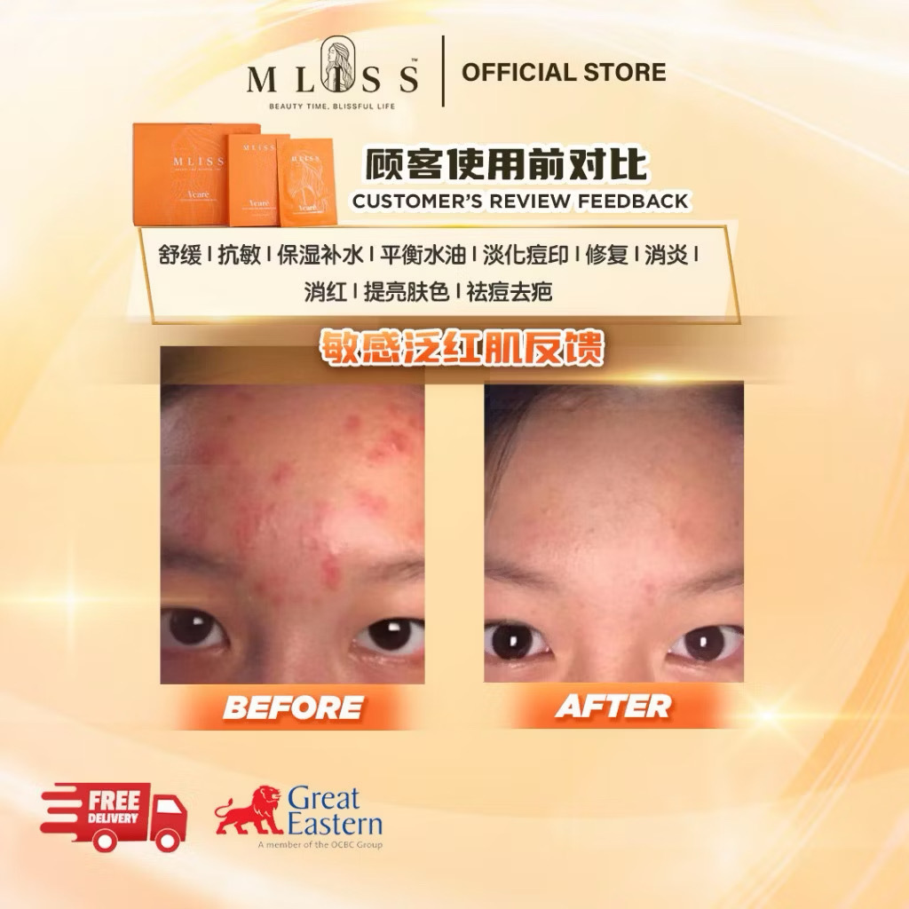 MLISS 面膜舒缓退红效果 - 15分钟极速修复