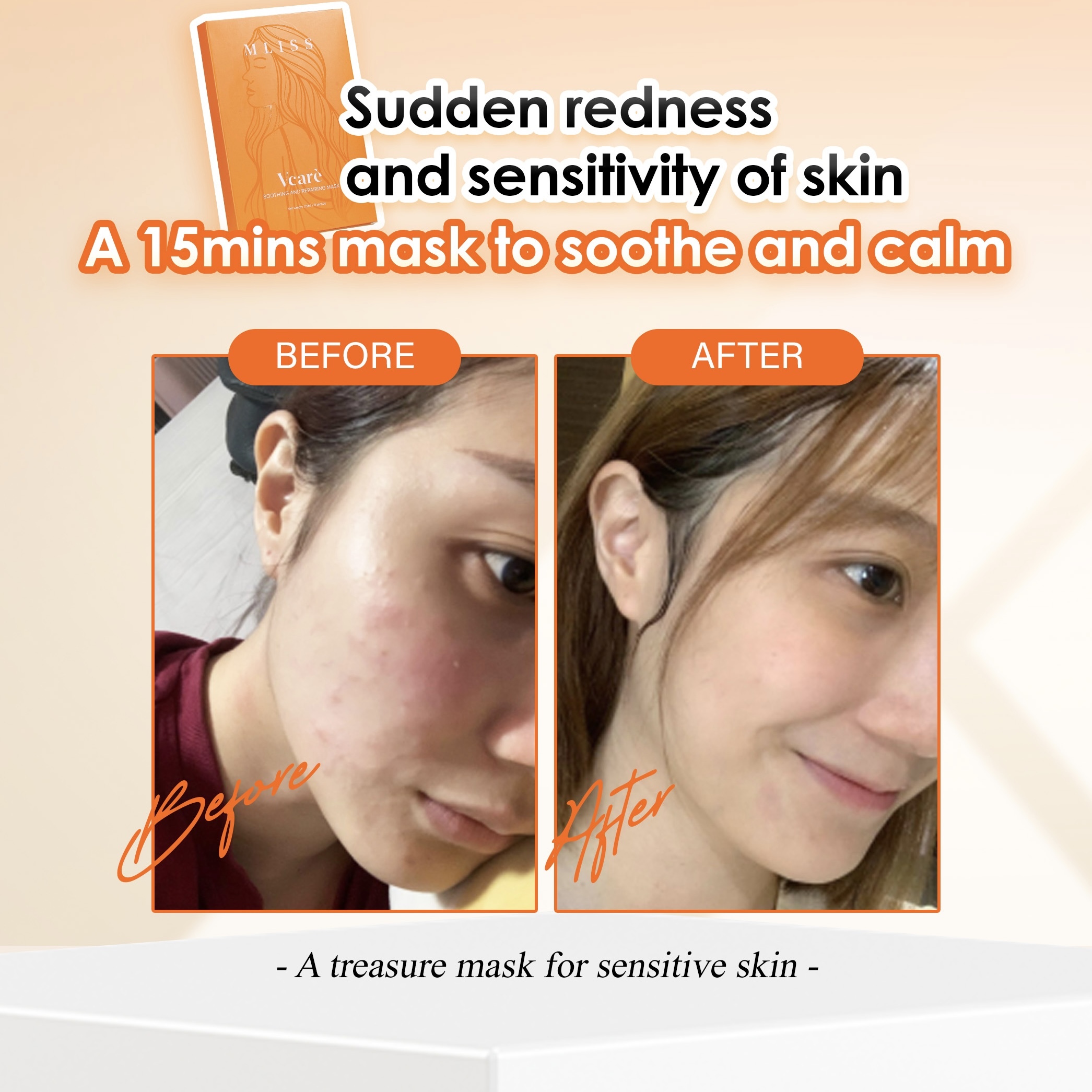 Kesan Pantas Kurangkan Alergi Kulit Dengan Masker MLISS Vcare