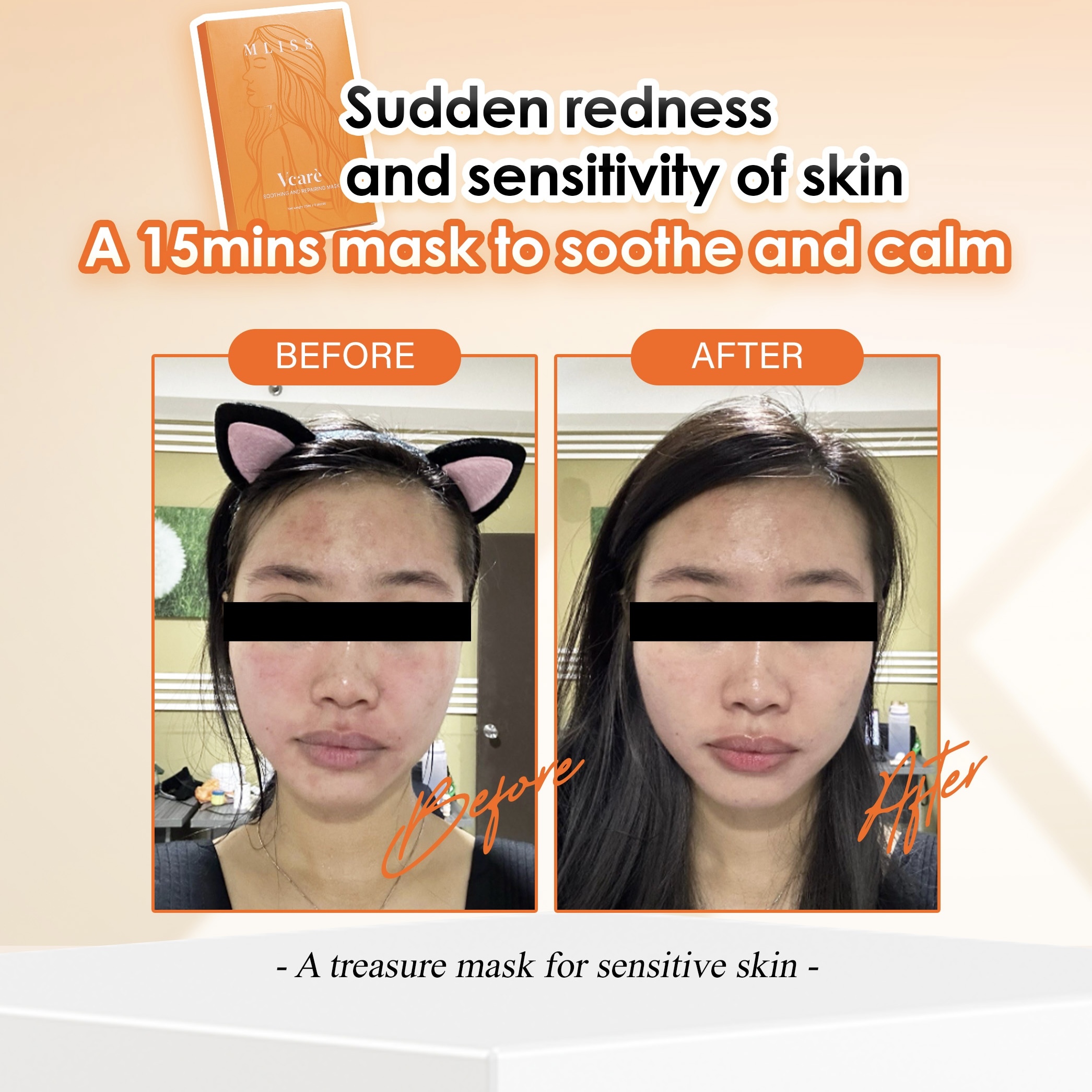 Real Testimony: Reducing Skin Allergy with MLISS