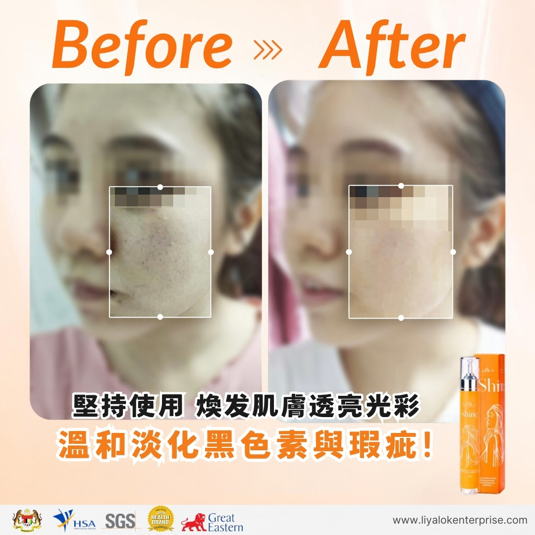 MLISS Shine 2.0 玻尿酸水光精華使用前後對比：溫和淡化黑色素與提亮透亮膚質