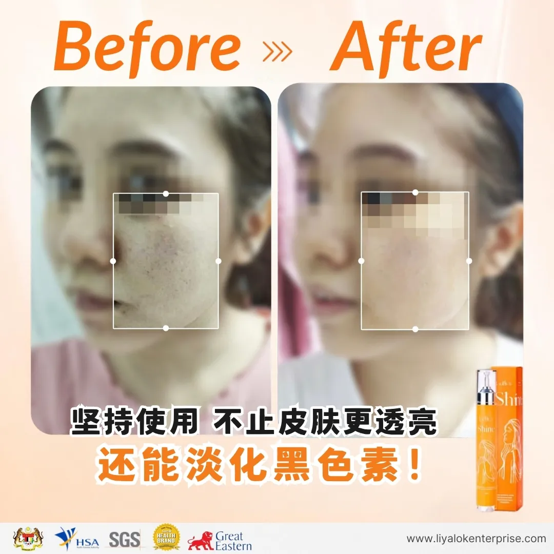 MLISS Shine 2.0 玻尿酸水光精华使用前后对比：淡化黑色素与提亮暗沉肌肤