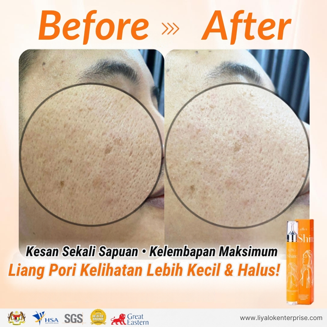 Kesan sekali sapuan MLISS Shine 2.0 Essence: Kelembapan optimum dan liang pori kelihatan halus