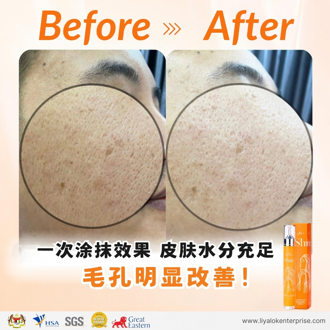 MLISS Shine 2.0 水光精华一次涂抹效果：深层补水与明显收缩粗大毛孔
