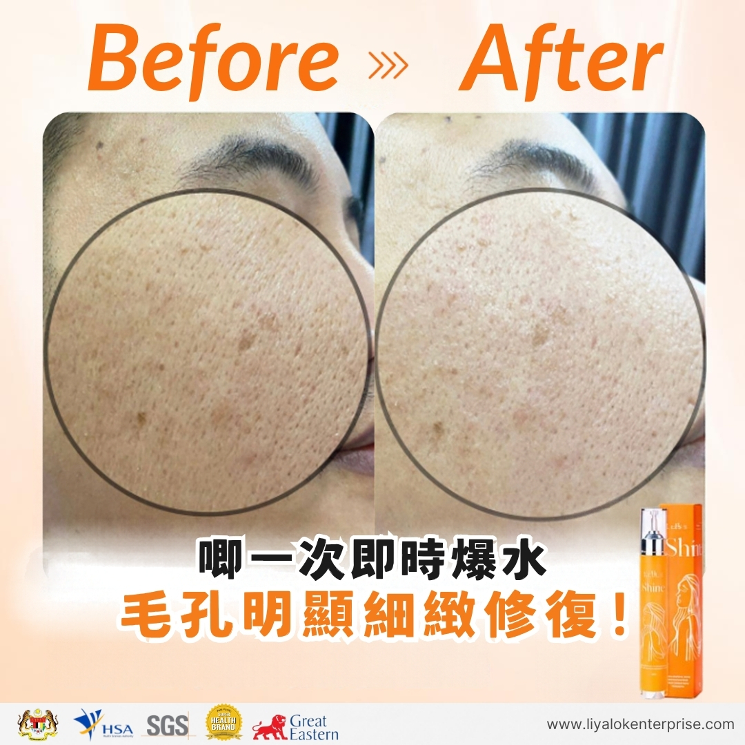 MLISS Shine 2.0 皇牌精華唧一次即時爆水：顯著修復粗大毛孔與改善缺水
