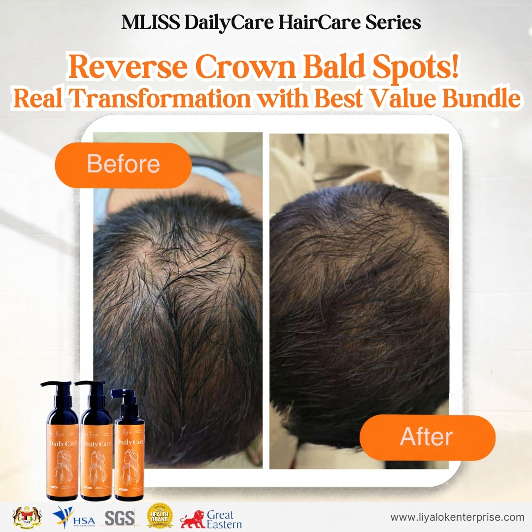 MLISS DailyCare Scalp Tonic - Bald Spot Regrowth Treatment Before After