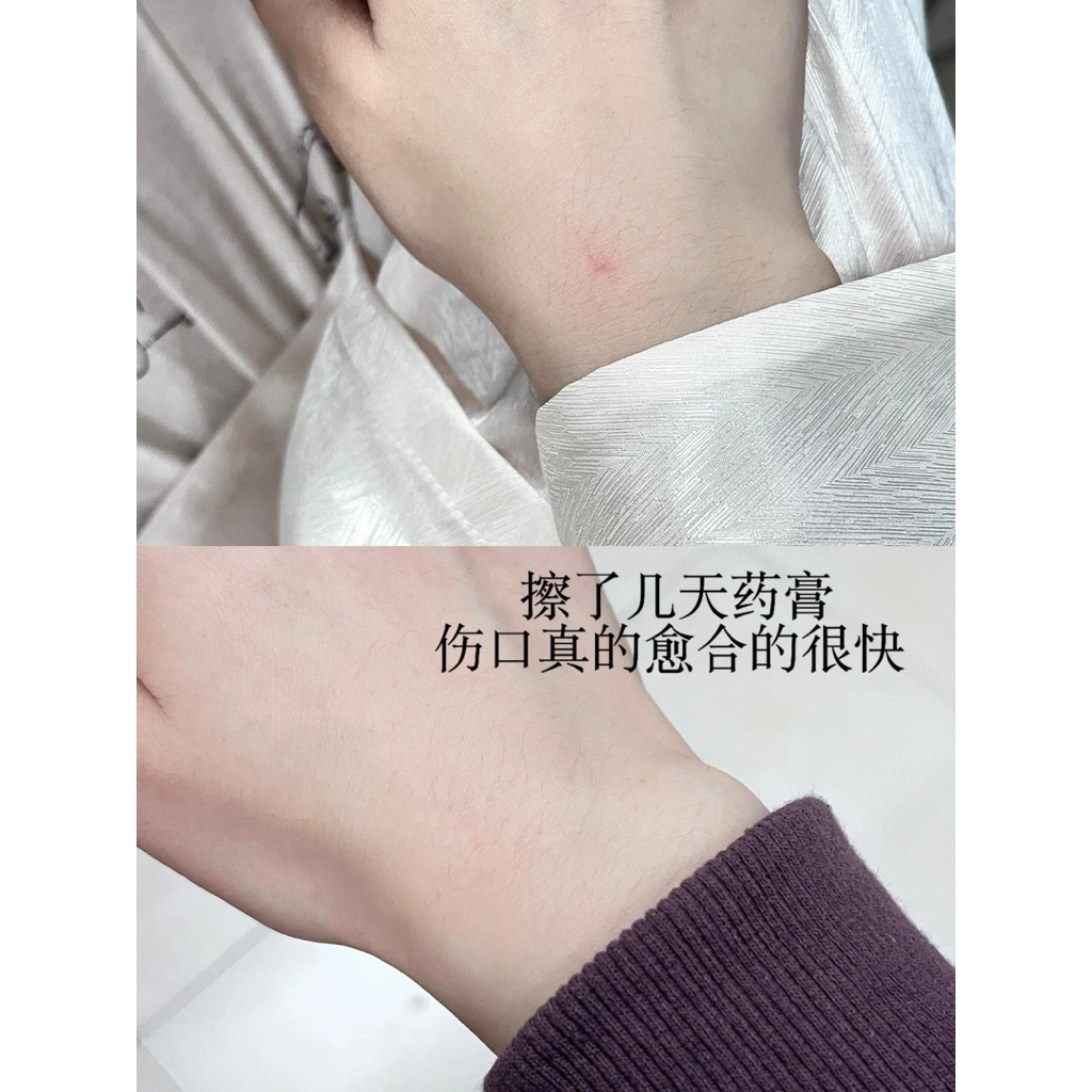 my-11134207-820l6-mh1o1dgtg2yx6a