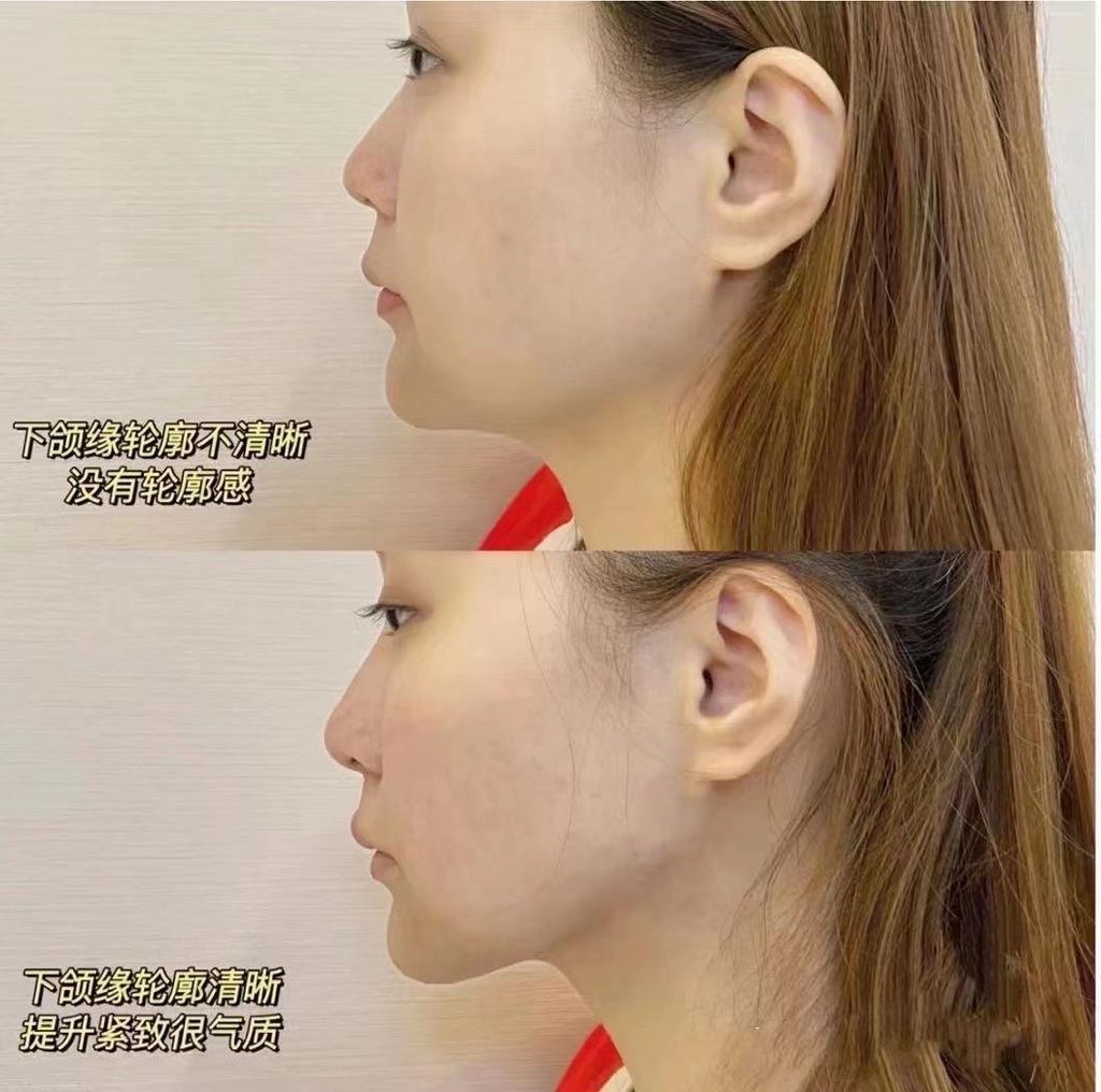 WhatsApp Image 2024-03-11 at 2.19.06 PM