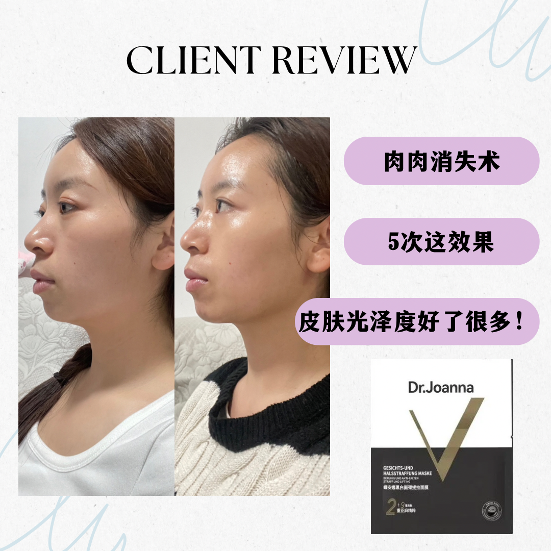 18AA05BF-D56B-4594-B8D0-BDE69750F564-1712393305786